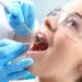 Dentist root canal