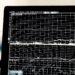 Graph screen